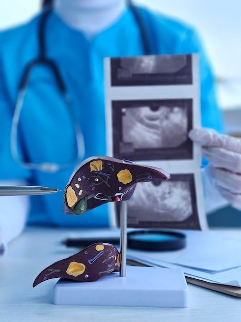 Model of liver anatomy displayed by a healthcare professional reviewing ultrasound images